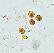 Blastocystis hominis
